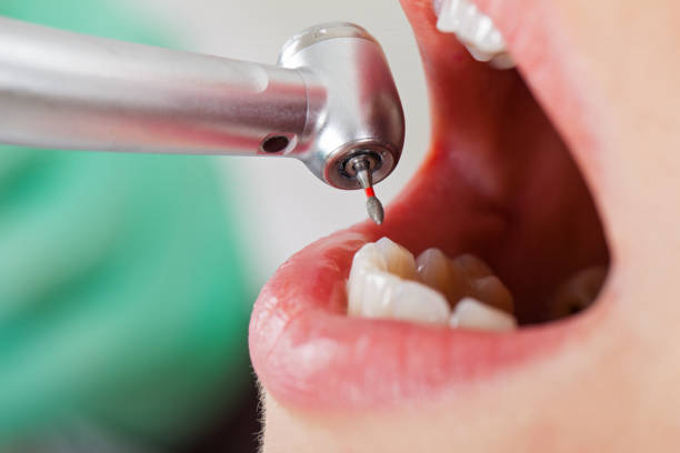 Best Urgent Dental Care in Newstle, CA
